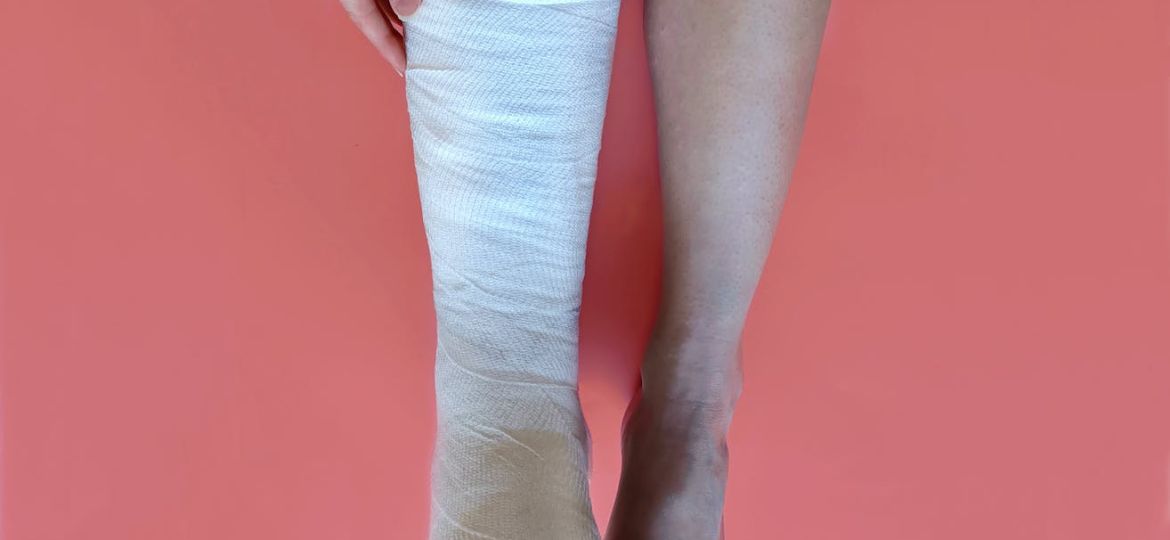 a person with a leg in a cast