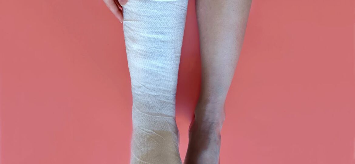 a person with a leg in a cast