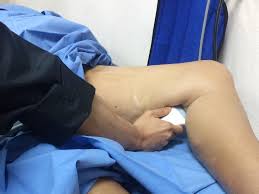 Medical Professional Performing Ultrasound to Detect DVT in Leg