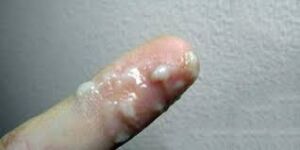 whitish cervical mucus on someone's finger