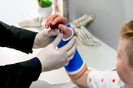 Casts care: Healthcare professional examining a synthetic blue arm cast on a child