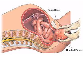Cross-section illustration of a the baby's position in the birth canal delivery in progress during the second stage
