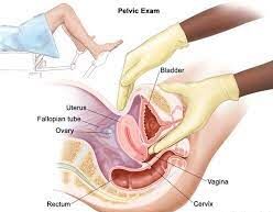 Cross section diagram illustrating a pelvic examination