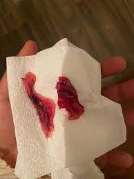 Blood on tissue paper possibly related to the menstruation cycle