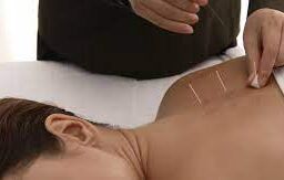 Person applying Acupuncture Needles - Traditional Chinese medicine practitioner administering holistic healing treatment.
