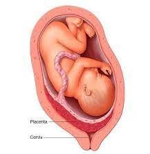 An anatomical cross-section of the uterus showing placenta previa, where the placenta is positioned low in the uterus, covering or lying near the cervix. The image highlights the abnormal placement of the placenta in relation to the cervix and fetus, with clear anatomical labels for educational purposes.