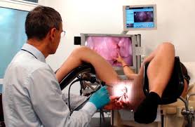 A doctor performing a colposcopy as part of diagnostic exams
