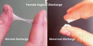 Person assessing the characteristics of vaginal discharge between their fingers.