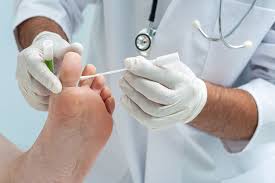 Close-up of a healthcare professional using a swab to collect a sample from the affected area on the foot