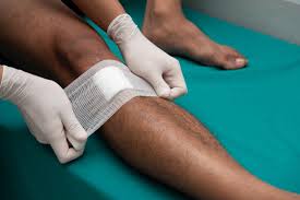 Applying dressing on a leg wound for proper healing