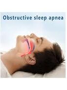 Obstructive sleep apnea demonstration: Recognizing airway blockages during sleep.