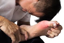 Gout Attack: Easing Big Toe Pain with Supportive Measures