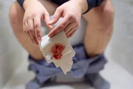 Person sitting on toilet with blood-stained tissue