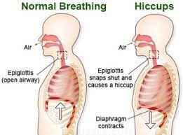 Comparison of normal breathing and breathing during hiccups