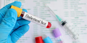 Blood tube labeled for cholesterol test