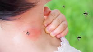 Person experiencing mosquito bites on the neck: Potential exposure to Aedes aegypti, carriers of Dengue, Zika, and Chikungunya.