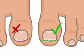 Toe nail trimming demonstration - Proper technique for diabetic foot care and circulatory health.