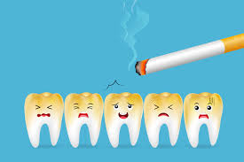 Smoking effects: Yellowing teeth due to light cigarette smoking