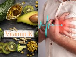 Man clutching his chest in pain next to a variety of Vitamin K sources - highlighting the importance of nutrition for heart health.