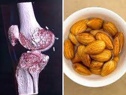 Visual representation: A bone beside a bowl of almonds - promoting bone health through calcium rich choices.