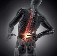 Skeletal illustration highlighting areas of chronic pain in the back