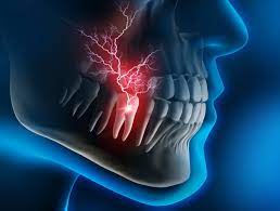 X-ray image showcasing the specific tooth causing the toothache.