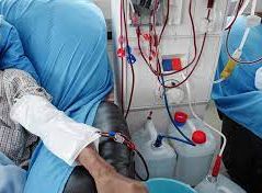 Dialysis patient undergoing life-saving treatment with a hemodialysis machine.