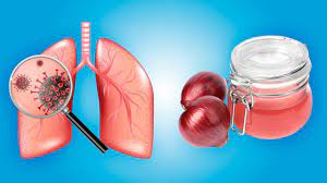 A visual representation of lungs with a microscopic view showcasing a pathogen, alongside onions and onion juice, emphasizing the respiratory health benefits of onions.