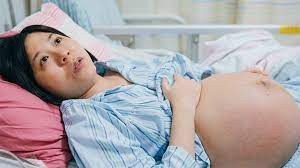 Woman benefiting from the effects of epidural anesthesia, coping well with labor pains.