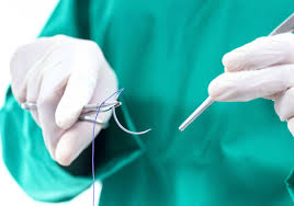 Image depicting a medical professional getting ready to close a wound with sutures