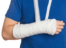 Cast care: Person with right arm cast supported by neck sling for comfort