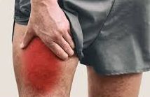 Close-up image showing muscle damage and swelling in the thigh due to rhabdomyolysis