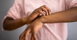 A person scratching their arm due to eczema flare-ups, illustrating the discomfort associated with this skin condition.