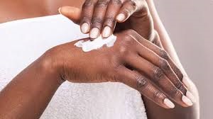 A person moisturizing their hands to manage eczema and relieve dry, irritated skin.